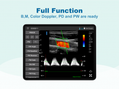 uREzpocus screenshot 4